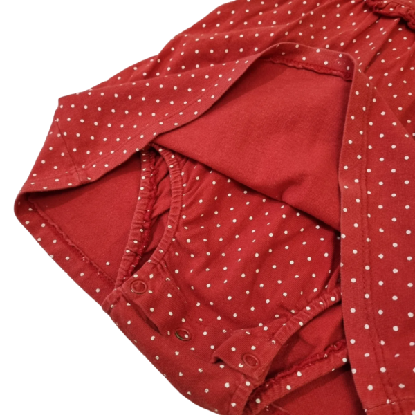 Vestido Cheeky - 6-9 meses - Image 4